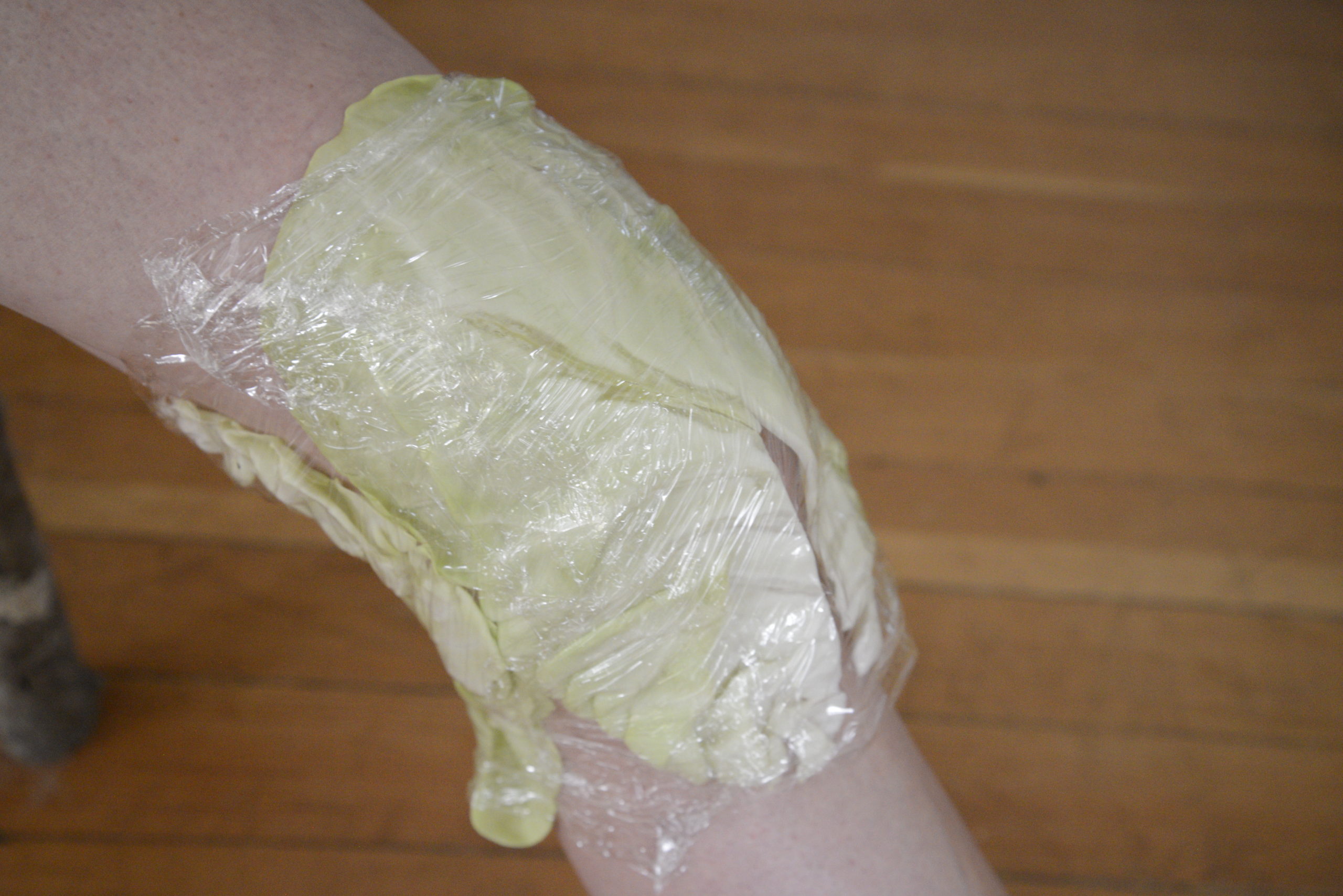 cabbage on knee wrapped with plastic